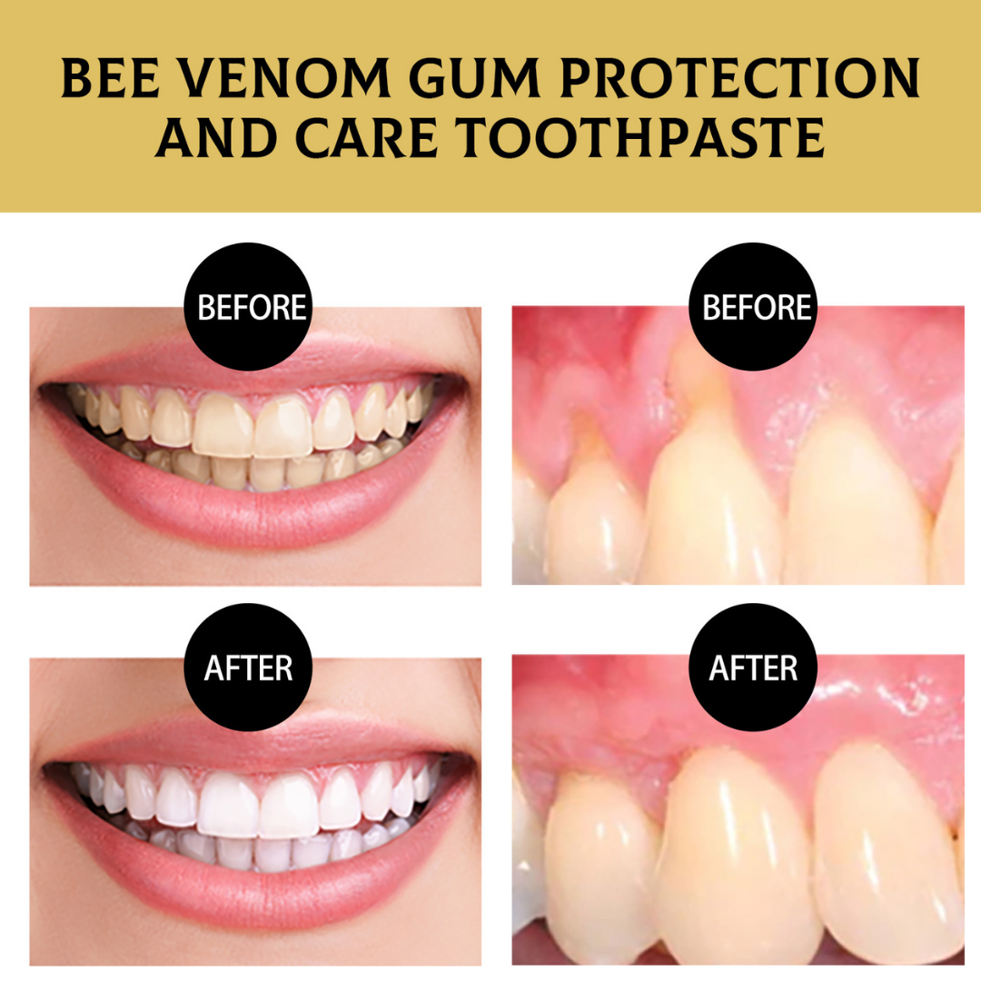 OVELLE™ Bee Venom Gum Care